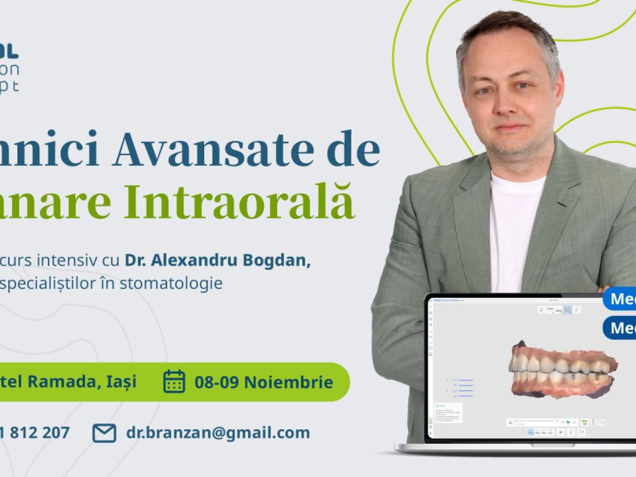 scanare intraorala
