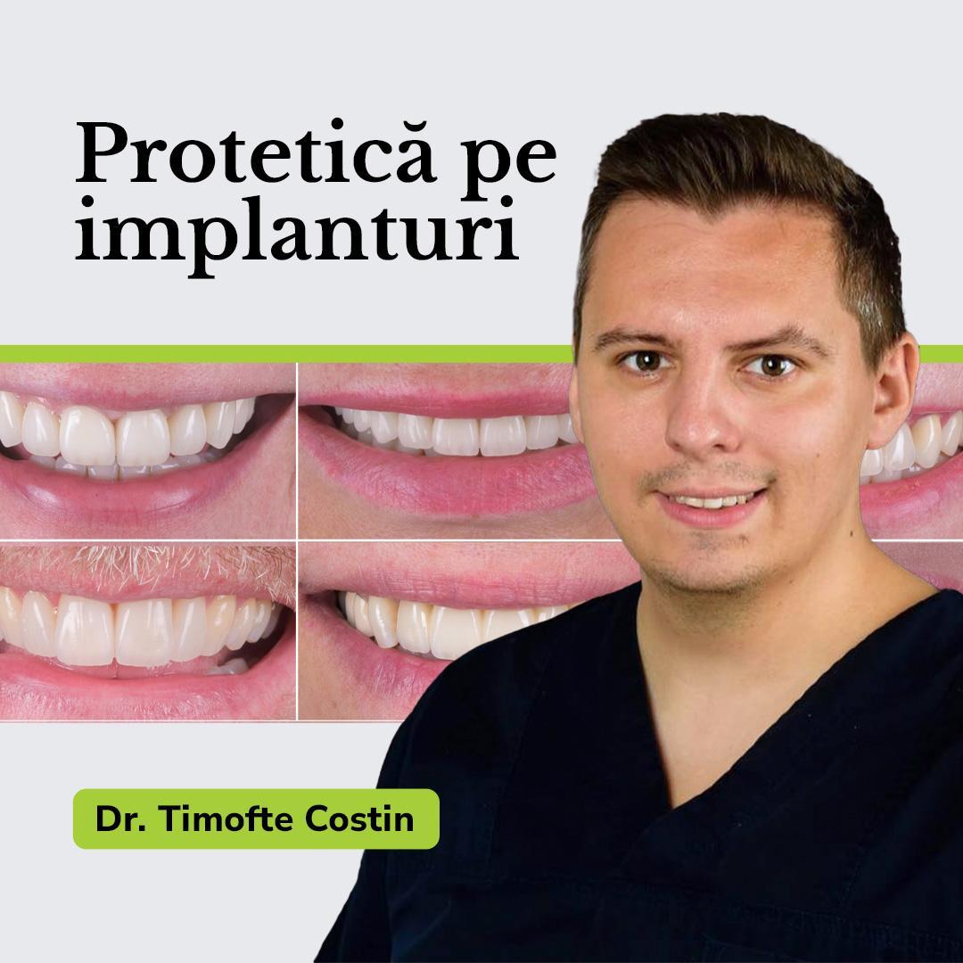 Protetică pe implanturi