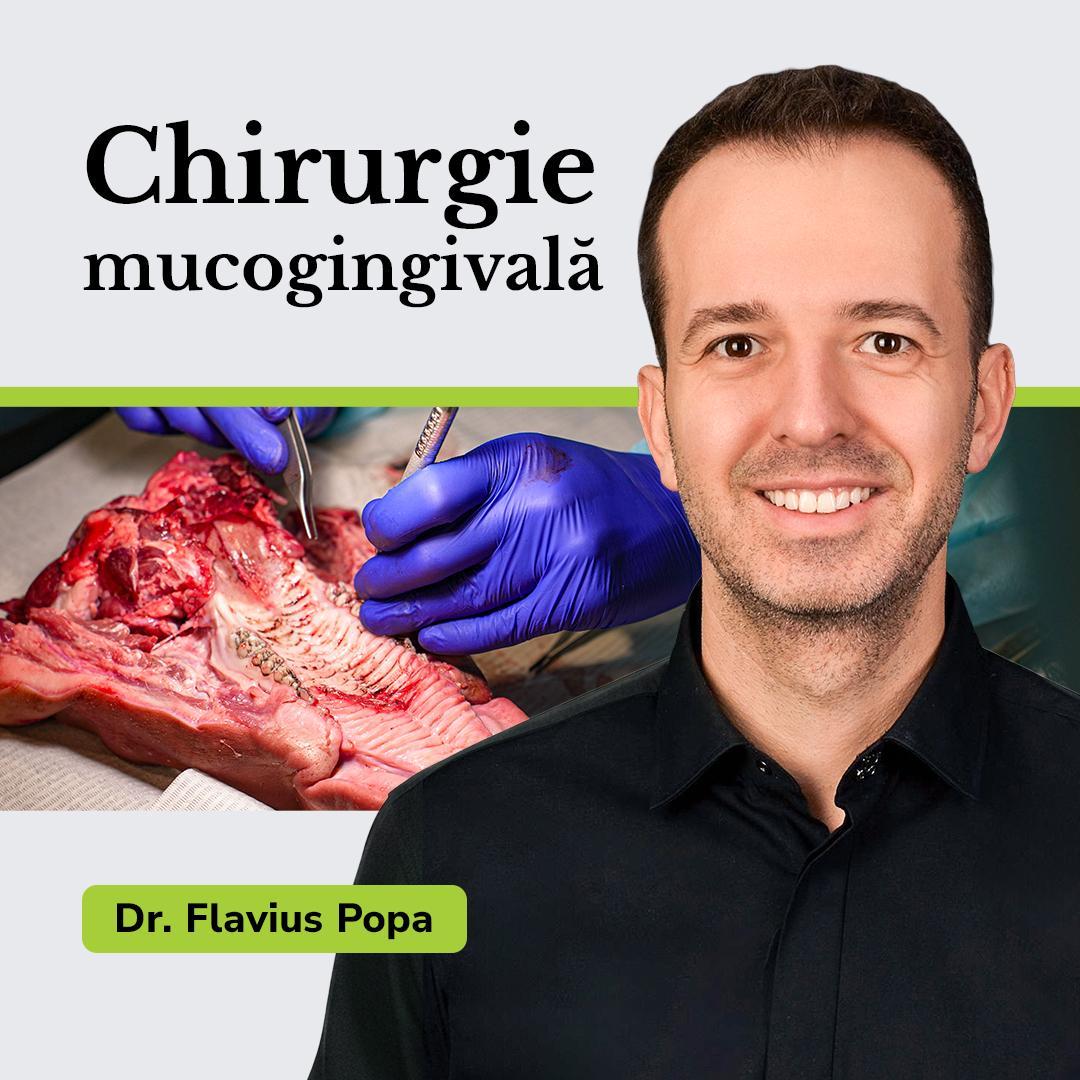 Chirurgie mucogingivala