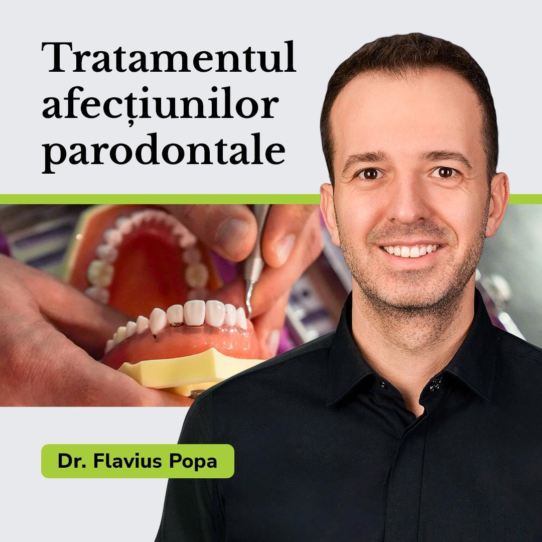 Tratamentul afecțiunilor parodontale