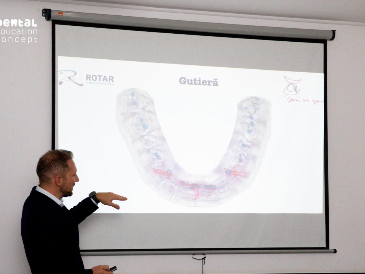 Gutierele Ocluzale și Disfuncția Temporo-Mandibulara
